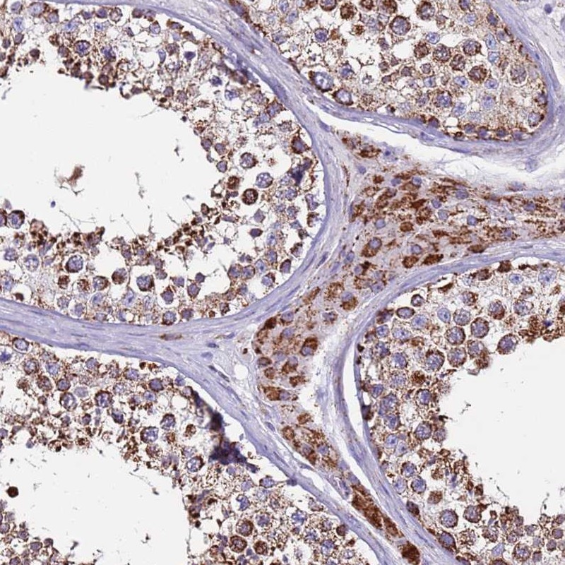 Atlas Antibodies Anti-ZBTB39 Antibody