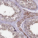 Atlas Antibodies Anti-ZBTB39 Antibody