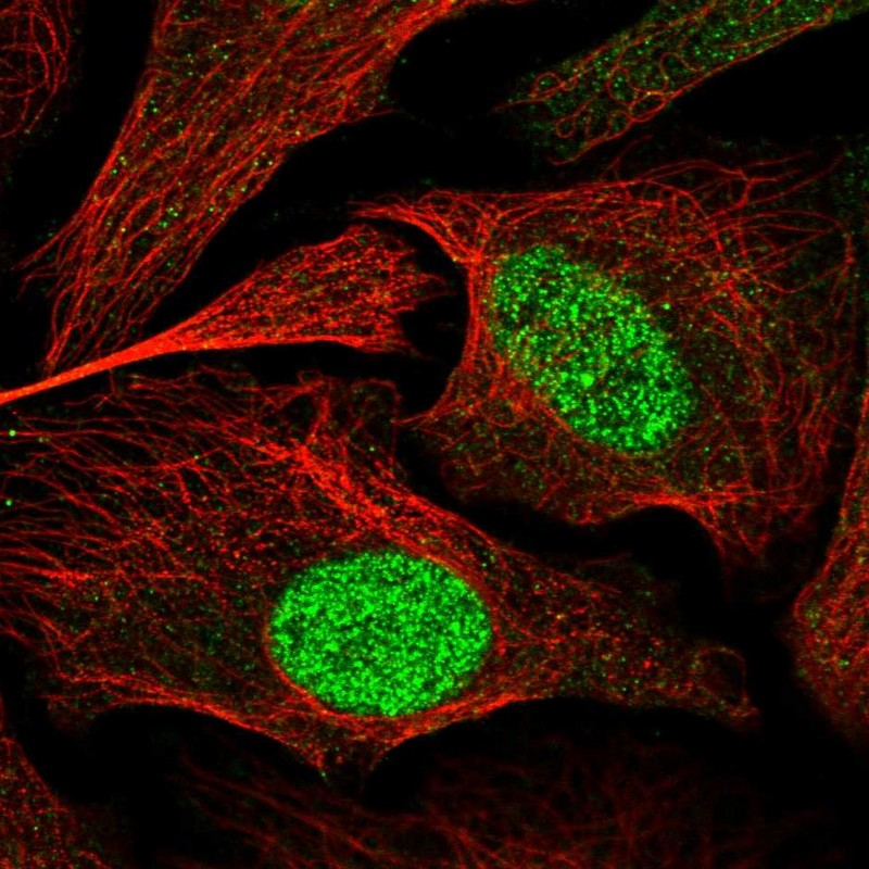 Atlas Antibodies Anti-ZBTB34 Antibody