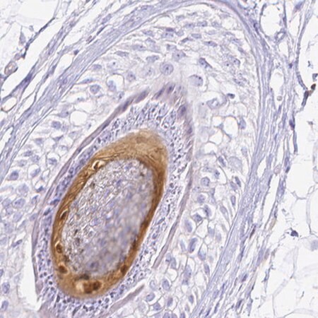 Merck ANTI-S100A3