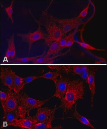 Merck Anti-Superoxide Dismutase (MnSOD) (KC-19) antibody produced in rabbit