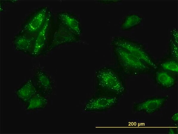 Merck Monoclonal Anti-SQSTM1 antibody produced in mouse