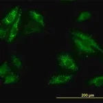 Merck Monoclonal Anti-SQSTM1 antibody produced in mouse