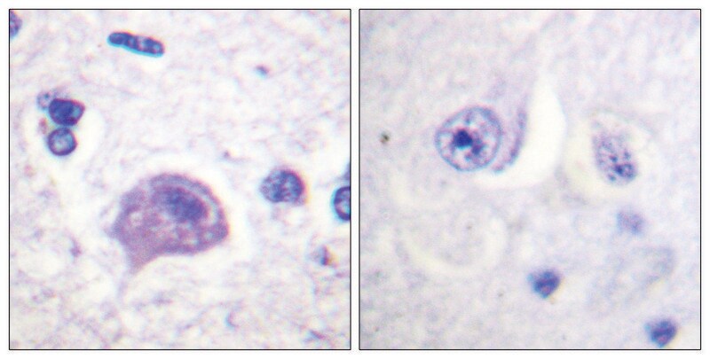 Merck Anti-HRS antibody produced in rabbit