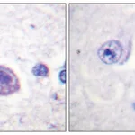 Merck Anti-HRS antibody produced in rabbit