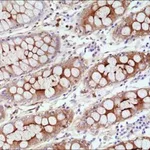 Merck ANTI-CEA (CD66E) ANTIBODY, RABBIT MONOCL