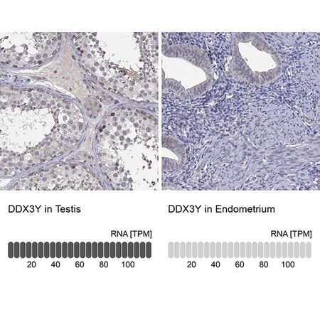 Merck Anti-DDX3Y antibody produced in rabbit