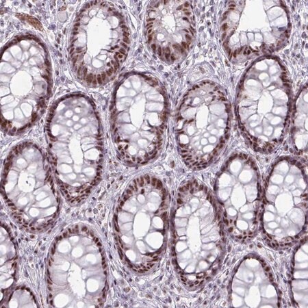 Merck Anti-NCOR1 antibody produced in rabbit