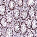 Merck Anti-NCOR1 antibody produced in rabbit