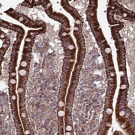Merck Anti-ANO10 antibody produced in rabbit