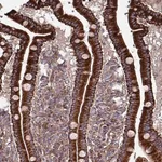 Merck Anti-ANO10 antibody produced in rabbit