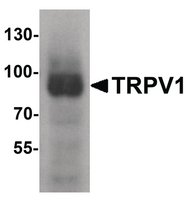Merck ANTI-TRPV1