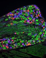 Merck ANTI-NEUROFILAMENT 160/200 ANTIBODY, MO&