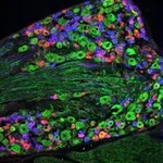 Merck ANTI-NEUROFILAMENT 160/200 ANTIBODY, MO&