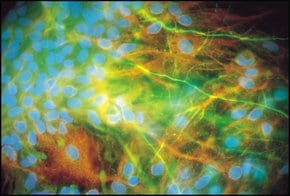 Merck RABBIT ANTI-NEUROFILAMENT 200