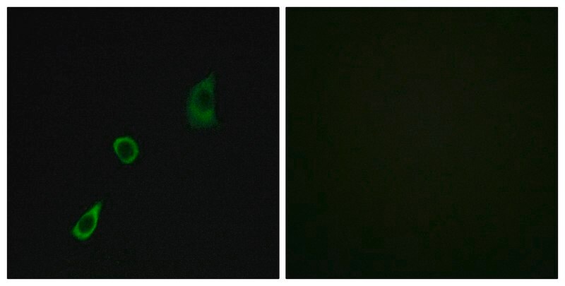 Merck Anti-FGF23 antibody produced in rabbit