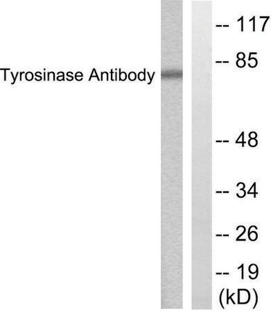Merck Anti-Tyrosinase antibody produced in rabbit