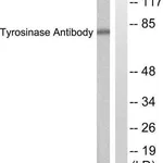 Merck Anti-Tyrosinase antibody produced in rabbit