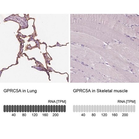 Merck Anti-GPRC5A antibody produced in rabbit