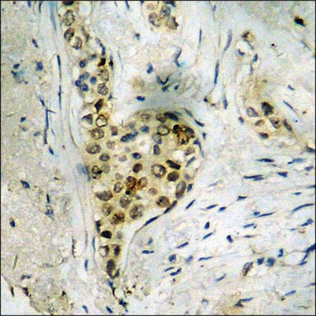 Merck Anti-phospho-DNA-PK (pSer2056) antibody produced in rabbit