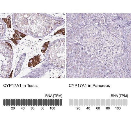 Merck Anti-CYP17A1 antibody produced in rabbit