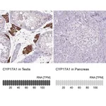 Merck Anti-CYP17A1 antibody produced in rabbit