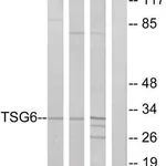 Merck Anti-TSG6 antibody produced in rabbit