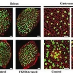Merck MONOCLONAL ANTI-SKELETAL MYOSIN (SLOW),&