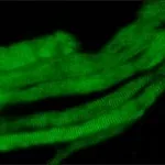 Merck MONOCLONAL ANTI-SKELETAL MYOSIN (FAST),&