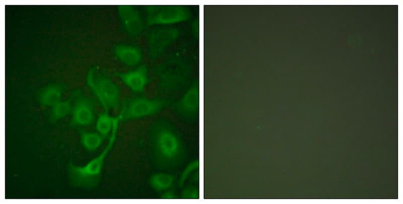 Merck Anti-TIMP2 antibody produced in rabbit