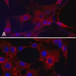 Merck Anti-Superoxide Dismutase (MnSOD) (DD-17) antibody produced in rabbit