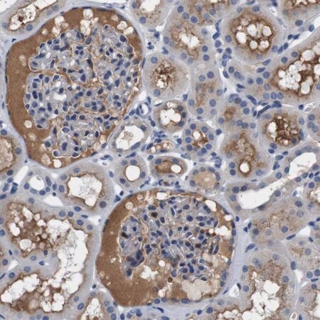 Merck Anti-C1RL antibody produced in rabbit