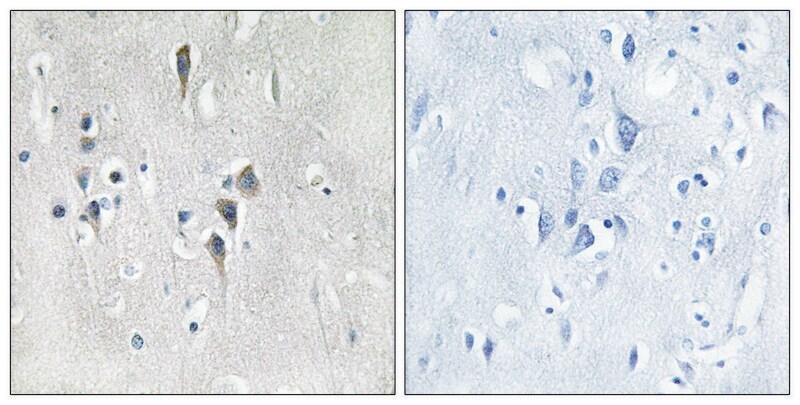 Merck Anti-CAMK2 antibody produced in rabbit