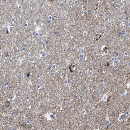 Merck Anti-HK1 antibody produced in rabbit