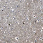 Merck Anti-HK1 antibody produced in rabbit