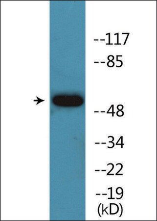 Merck Anti-phospho-Akt (pSer124) antibody produced in rabbit