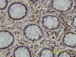Merck MONOCLONAL ANTI-CALR