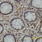 Merck MONOCLONAL ANTI-CALR