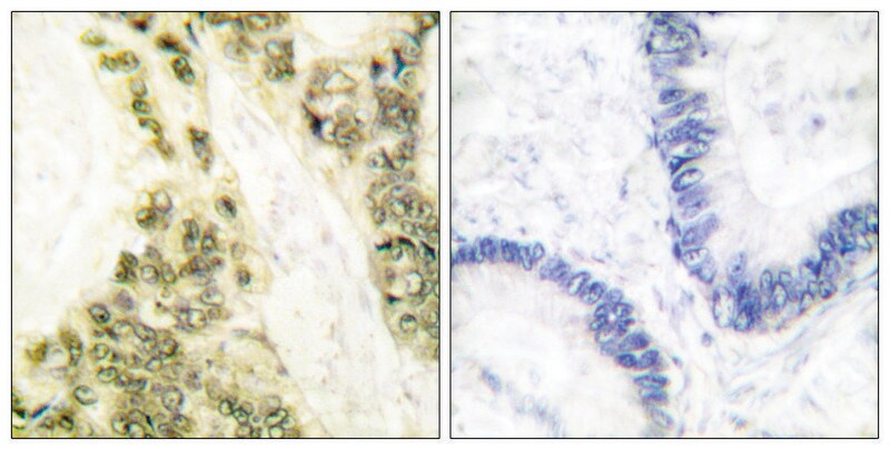 Merck Anti-Thyroid Hormone Receptor alpha, N-Terminal antibody produced in rabbit