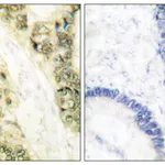 Merck Anti-Thyroid Hormone Receptor alpha, N-Terminal antibody produced in rabbit