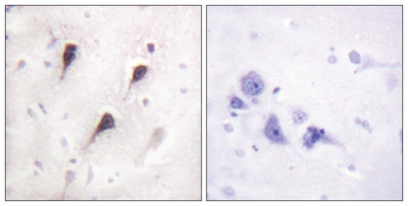Merck Anti-WAVE1 antibody produced in rabbit