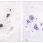 Merck Anti-WAVE1 antibody produced in rabbit