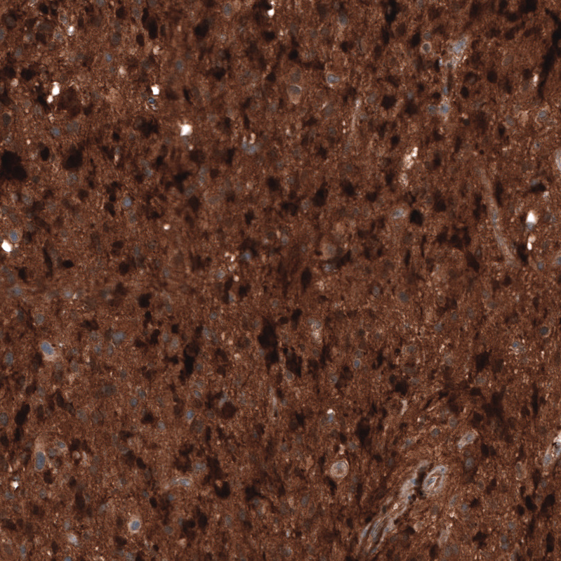 Atlas Antibodies Anti-CHI3L1 Antibody