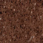Atlas Antibodies Anti-CHI3L1 Antibody