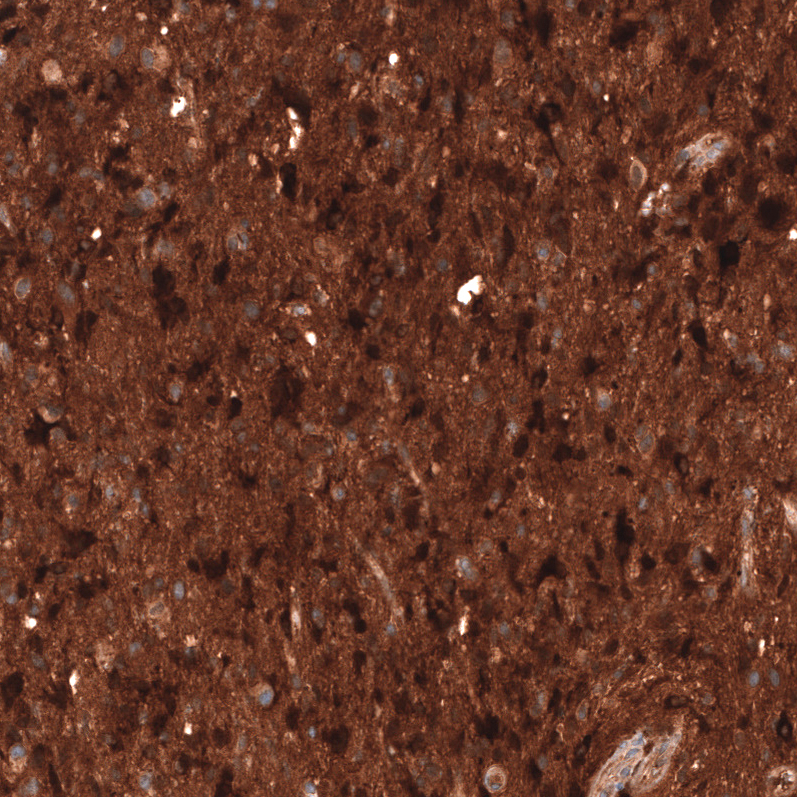 Atlas Antibodies Anti-CHI3L1 Antibody
