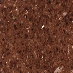 Atlas Antibodies Anti-CHI3L1 Antibody