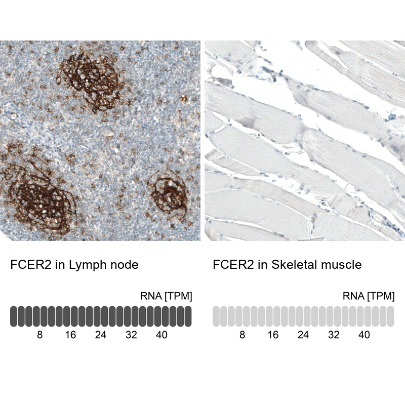 Atlas Antibodies Anti-FCER2 Antibody