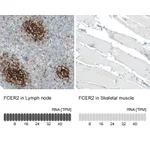Atlas Antibodies Anti-FCER2 Antibody