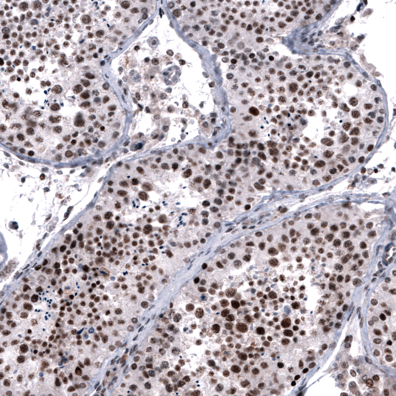 Atlas Antibodies Anti-FOXM1 Antibody