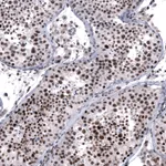 Atlas Antibodies Anti-FOXM1 Antibody